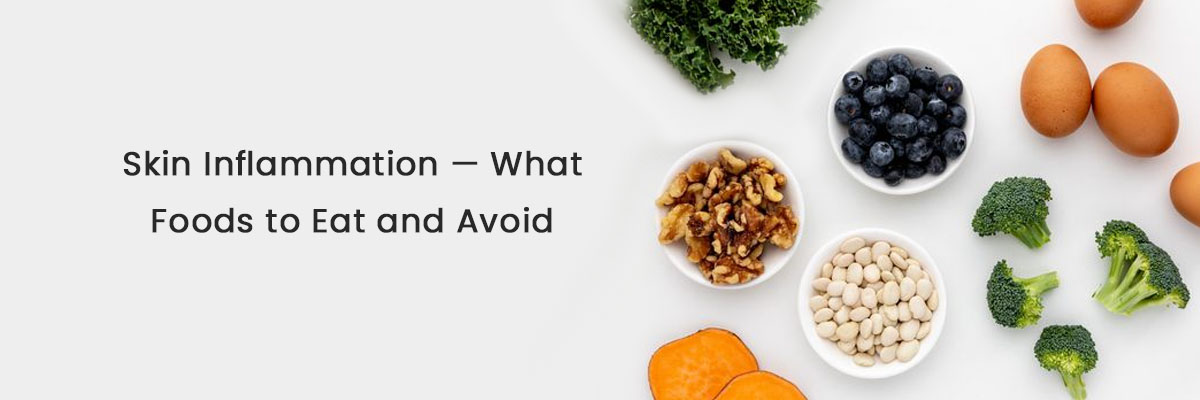 Skin Inflammation - What Foods to Eat and Avoid